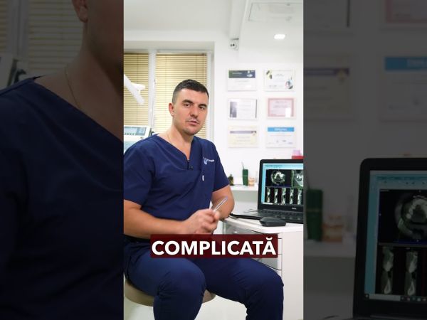 Pacientă, 58 de ani, s-a confruntat cu durere și dinți mobili
