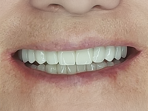 After