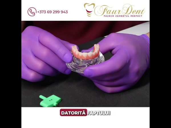 Ce este Dantura Fixă pe implanturi?