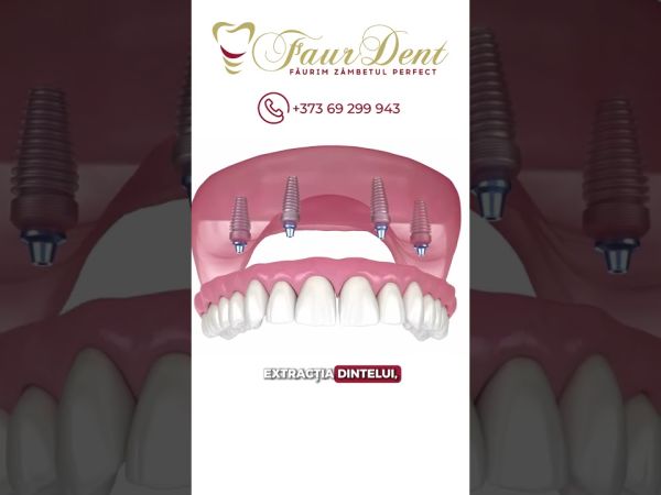 Zâmbet minunat fără durere