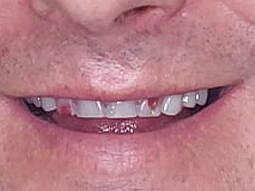 Before