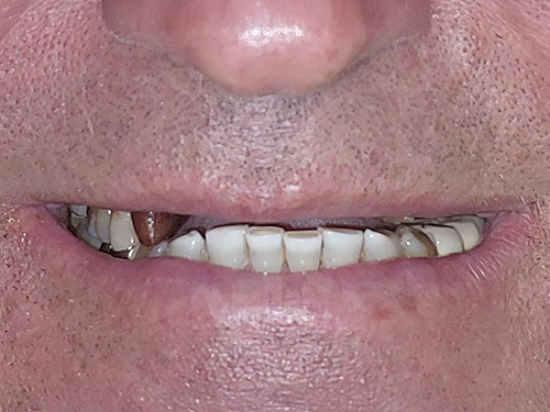 Before