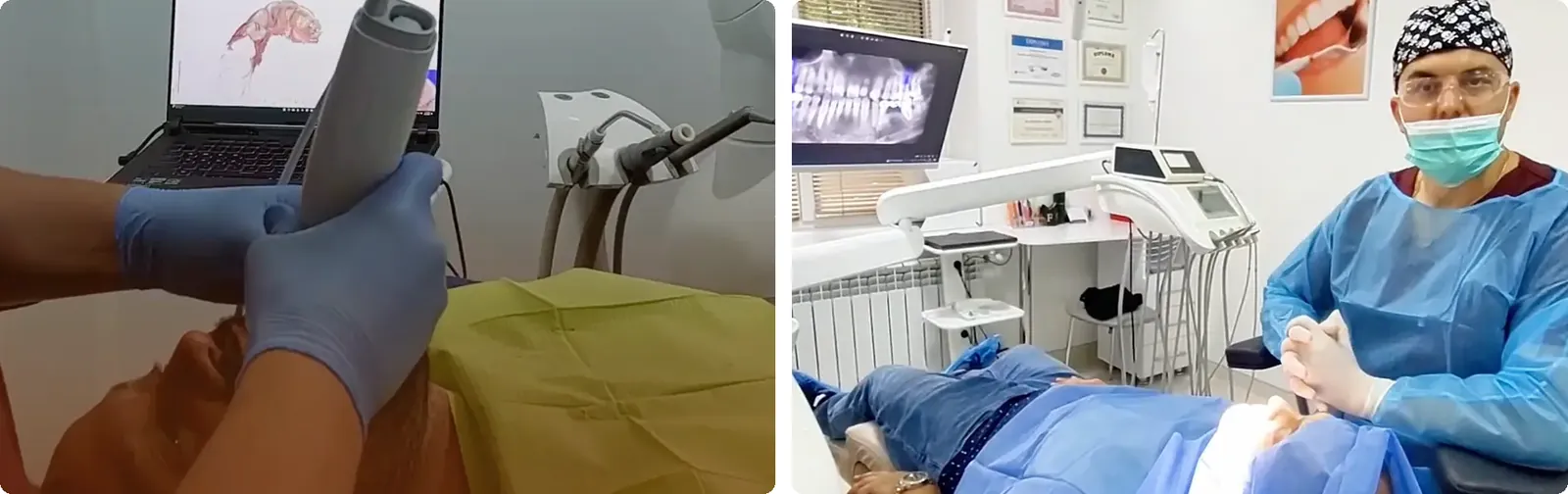 Scanarea 3D a dinților și inserarea implantului