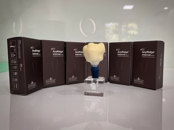 Dental Implants in Chișinău AnyRidge by MegaGen