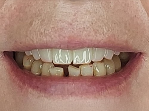 After