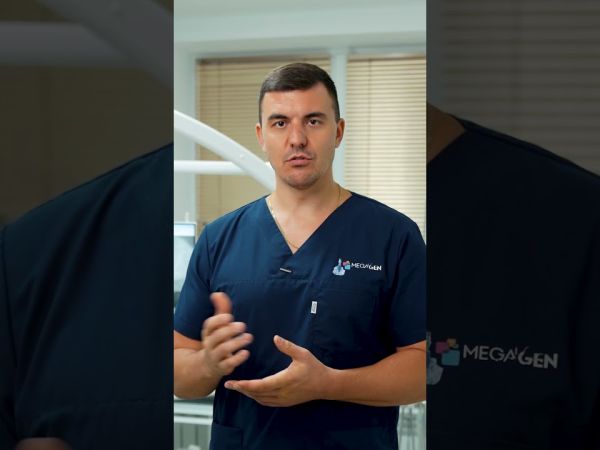 În cât timp se fixează un implant?